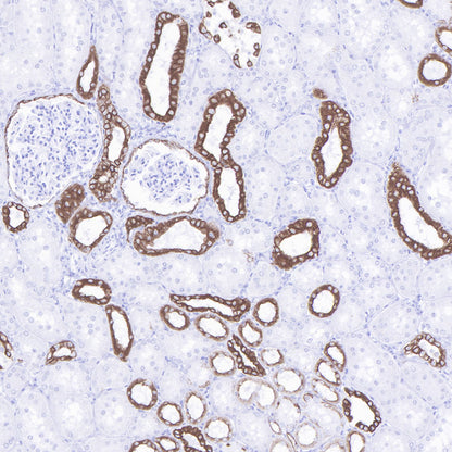 S-RMab® CK-Pan Recombinant Rabbit mAb (SDT-P001)