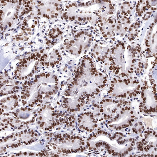 JunB Recombinant Rabbit mAb (S-R294)