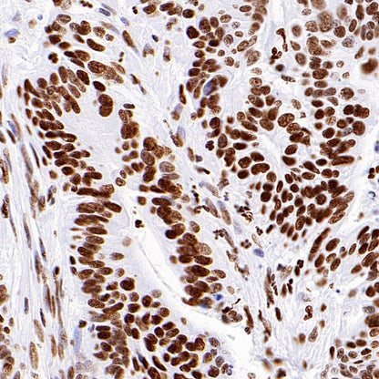 Histone H3 (acetyl K9) Recombinant Rabbit mAb (S-1704-76)