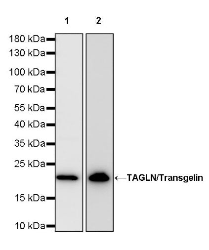 TAGLN/Transgelin Recombinant Rabbit mAb (S-1715-59)