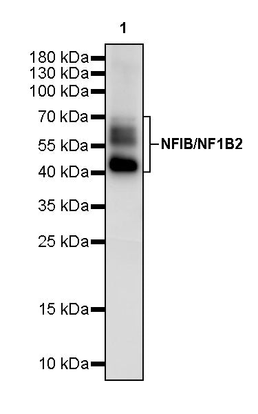 NFIB / NF1B2 Recombinant Rabbit mAb (S-3046-78)