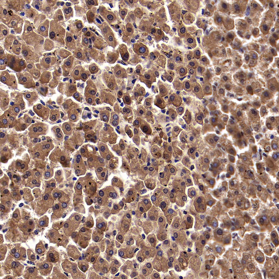 Pklr Recombinant Rabbit mAb (S-4114-40)