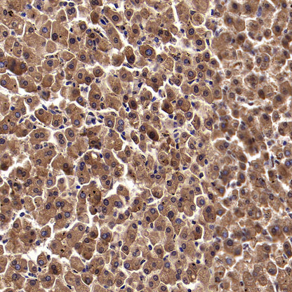 Pklr Recombinant Rabbit mAb (S-4114-40)