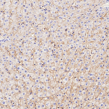 SLC30A1/ZnT1 Rabbit Polyclonal Antibody