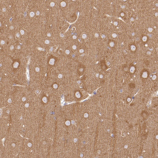DRP1 Recombinant Rabbit mAb (S-1927-27)