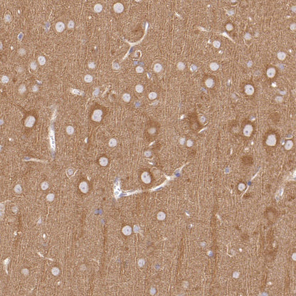 DRP1 Recombinant Rabbit mAb (S-1927-27)