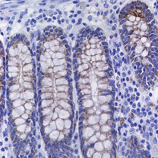 TMPRSS2 Recombinant Rabbit mAb (S-735-40)