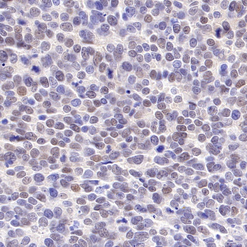 CDK6 Recombinant Rabbit mAb (S-1312-23)