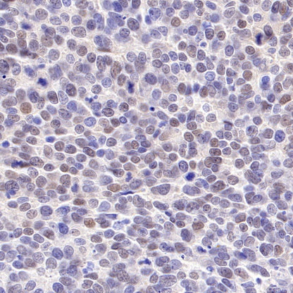 CDK6 Recombinant Rabbit mAb (S-1312-23)