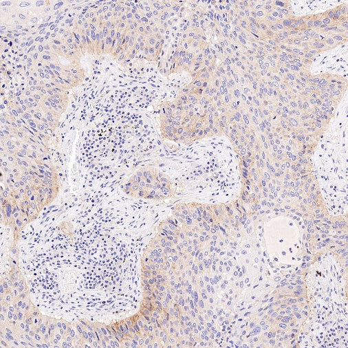 AMPKα Recombinant Rabbit mAb (S-784-68)
