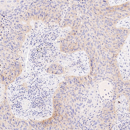 AMPKα Recombinant Rabbit mAb (S-784-68)