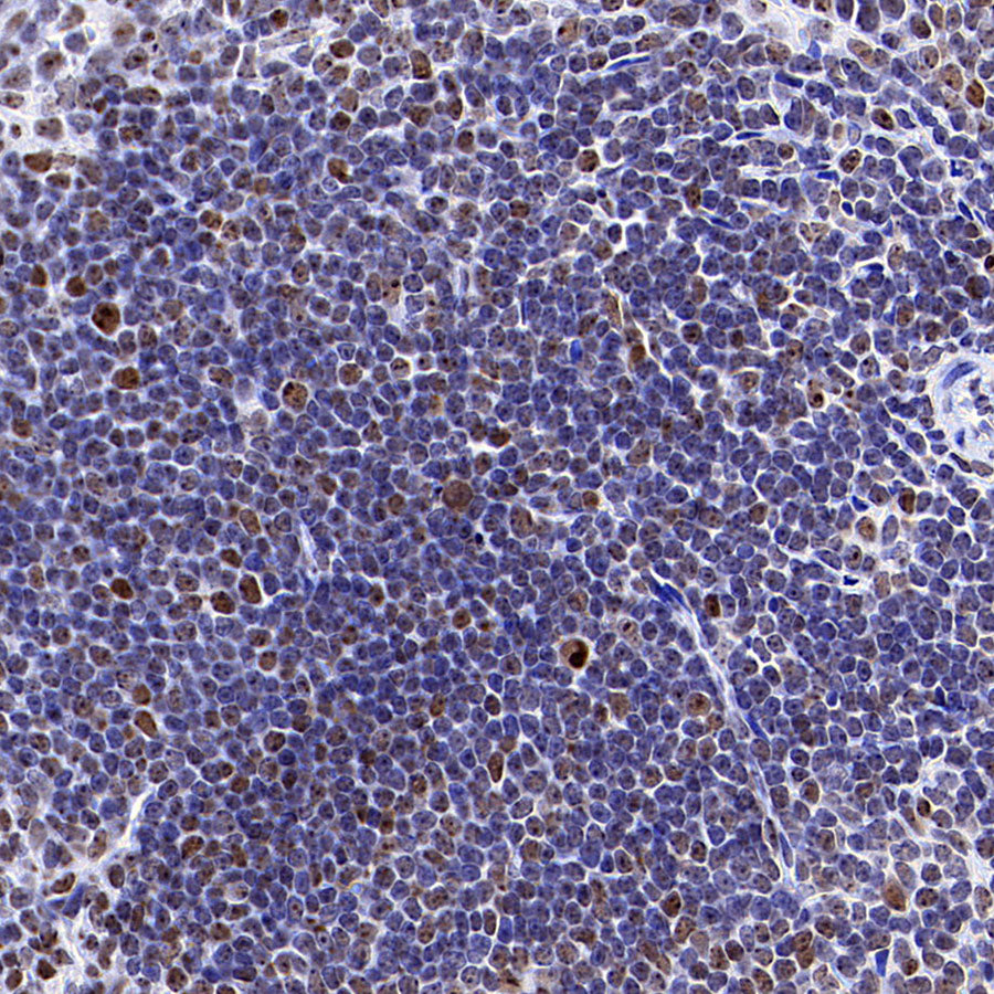 NPM1 Recombinant Rabbit mAb (S-4119-58)