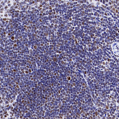 NPM1 Recombinant Rabbit mAb (S-4119-58)