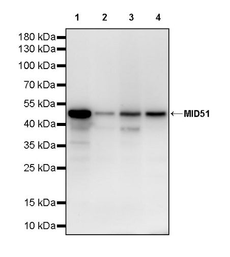 MID51 Recombinant Rabbit mAb (S-3570-28)
