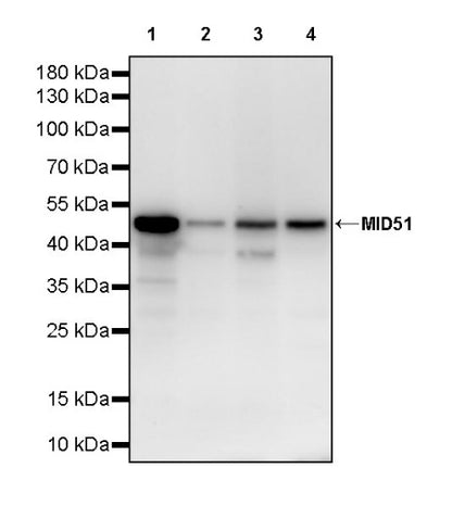 MID51 Recombinant Rabbit mAb (S-3570-28)