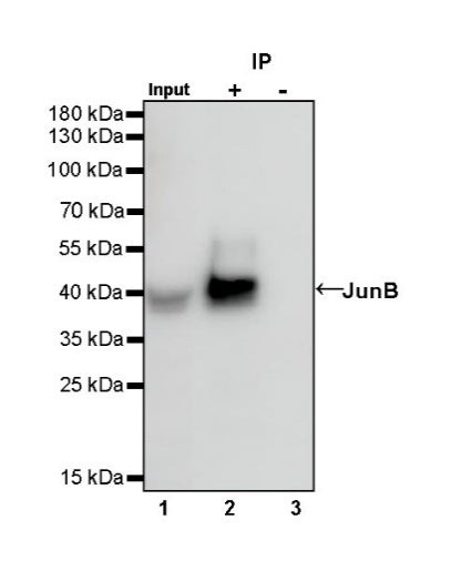 JunB Recombinant Rabbit mAb (S-670-242)