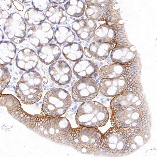 Integrin beta 4 Recombinant Rabbit mAb (S-1625-170)