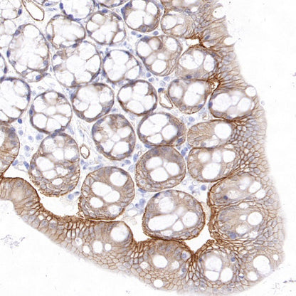 Integrin beta 4 Recombinant Rabbit mAb (S-1625-170)