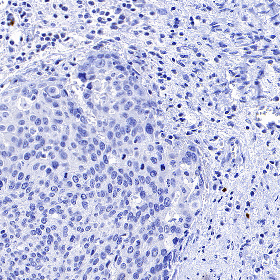 Phospho-HSP27 (Ser82) Recombinant Rabbit mAb (S-4792)