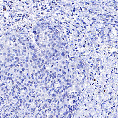 Phospho-HSP27 (Ser82) Recombinant Rabbit mAb (S-4792)