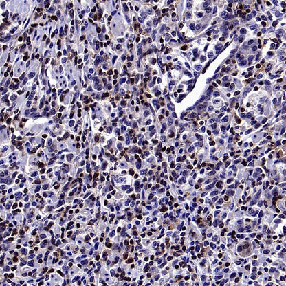 Stat5b Recombinant Rabbit mAb (S-2951-34)
