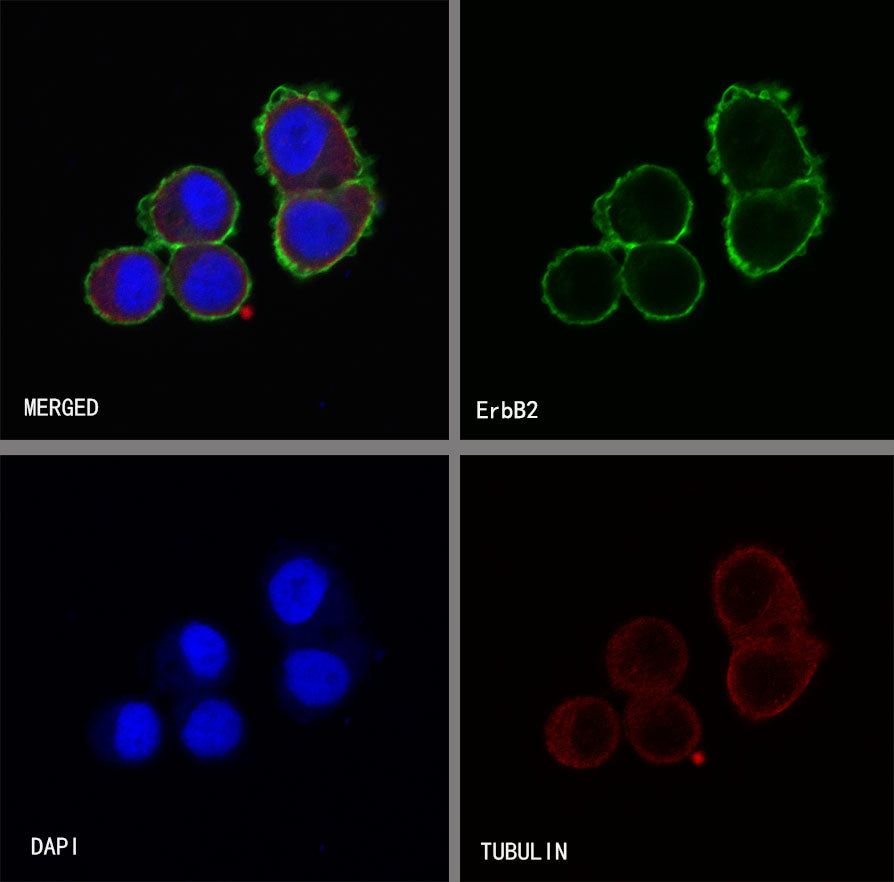 ErbB2 Recombinant Rabbit mAb (SDT-069-10)