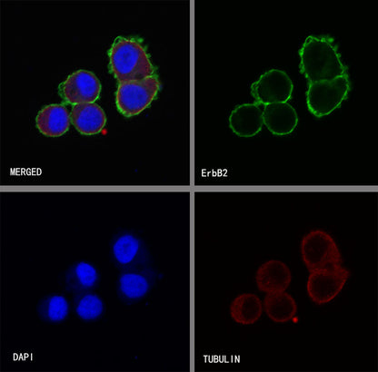 ErbB2 Recombinant Rabbit mAb (SDT-069-10)