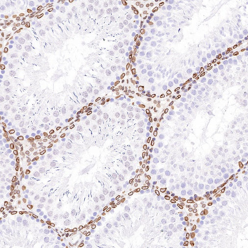 S-RMab®Lamin B2 Recombinant Rabbit mAb (S-951-70)