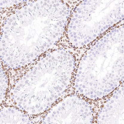 S-RMab®Lamin B2 Recombinant Rabbit mAb (S-951-70)