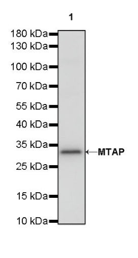 MTAP Recombinant Rabbit mAb (S-R363)