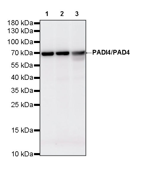 PADI4/PAD4 Recombinant Rabbit mAb (S-4347-19)