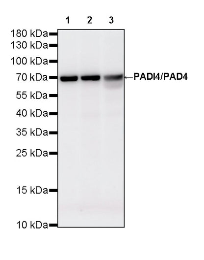 PADI4/PAD4 Recombinant Rabbit mAb (S-4347-19)