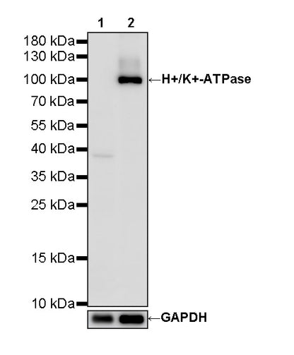 H+/K+-ATPase Recombinant Rabbit mAb (S-3474-110)