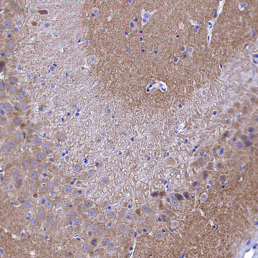 GRIA2 Recombinant Rabbit mAb (S-3446-123)