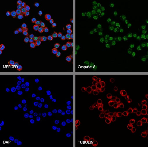 Caspase-8 Recombinant Rabbit mAb (S-2676-74)