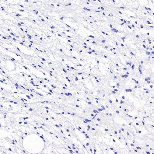 TMEM16A Recombinant Rabbit mAb (SDT-2179-12)