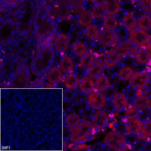AMACR/p504s Recombinant Rabbit mAb (Alexa Fluor® 555 Conjugate) (SDT-401-29)
