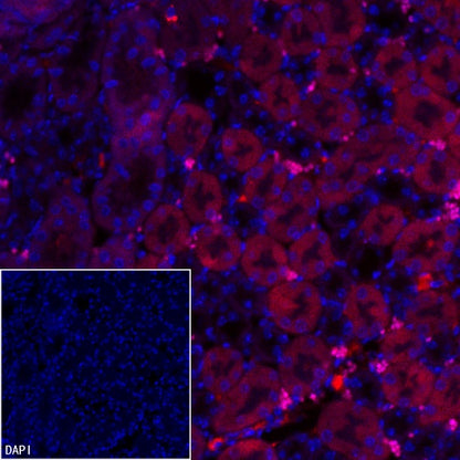 AMACR/p504s Recombinant Rabbit mAb (Alexa Fluor® 555 Conjugate) (SDT-401-29)