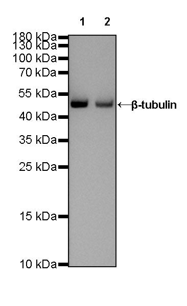 β-tubulin Recombinant Rabbit mAb (SDT-312-113)