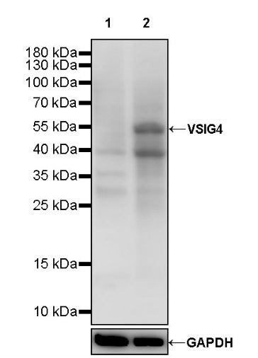 VSIG4 Recombinant Rabbit mAb (SDT-2737-61)