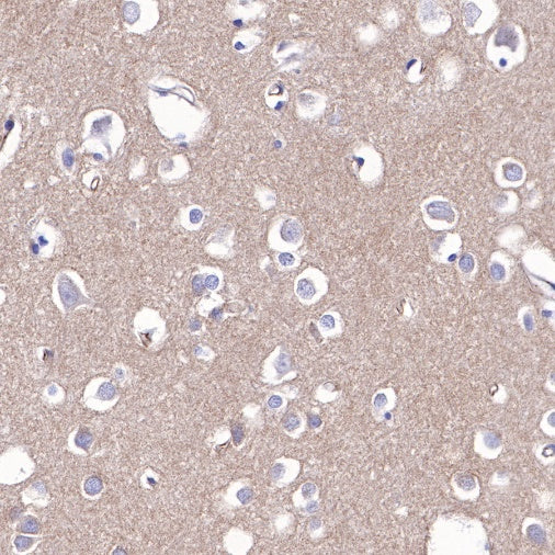 Non-muscle Myosin IIB/MYH10 Recombinant Rabbit mAb (S-299-3)