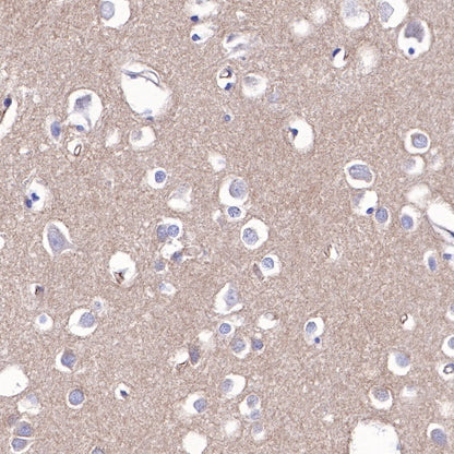 Non-muscle Myosin IIB/MYH10 Recombinant Rabbit mAb (S-299-3)