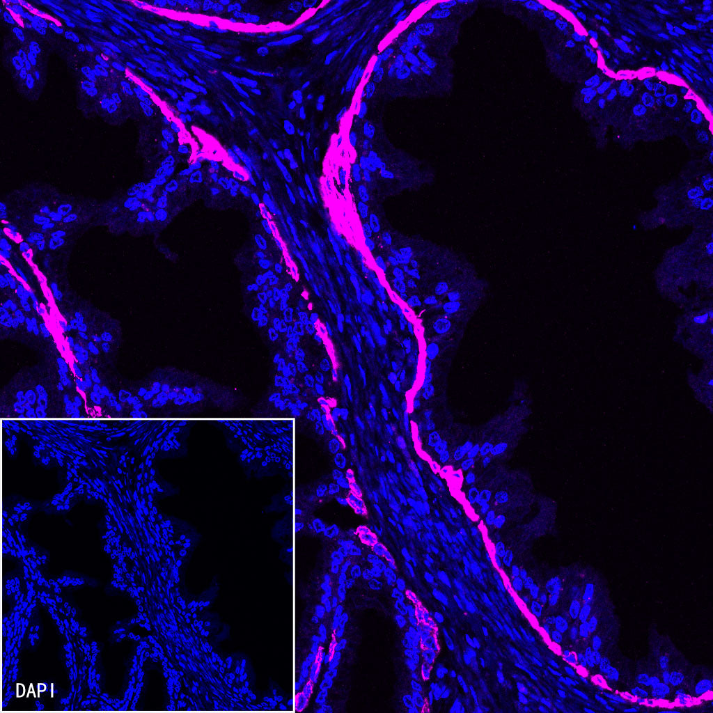 S-RMab® CK5/6 Recombinant Rabbit mAb,PBS Only (SDT-P004)