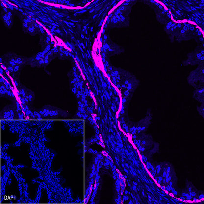 S-RMab® CK5/6 Recombinant Rabbit mAb,PBS Only (SDT-P004)