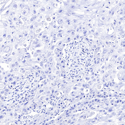 CK-LMW Recombinant Rabbit mAb (SDT-P003)