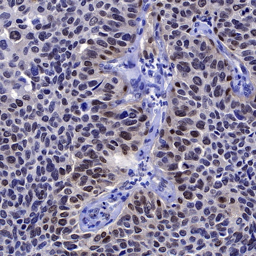 SMAD3 Recombinant Rabbit mAb (S-517-122)