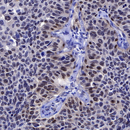 SMAD3 Recombinant Rabbit mAb (S-517-122)