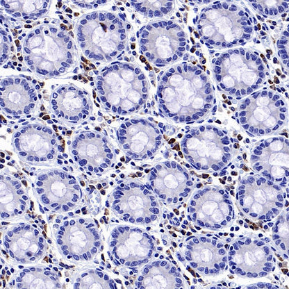 MACIR Rabbit Polyclonal Antibody