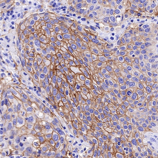 TACSTD2/TROP2 Recombinant Rabbit mAb (S-R237)