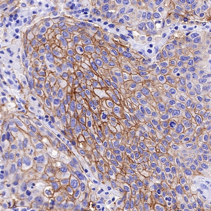 TACSTD2/TROP2 Recombinant Rabbit mAb (S-R237)